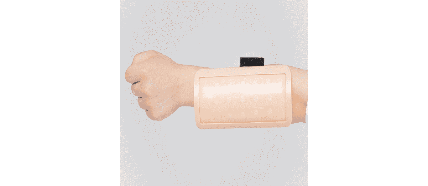 SP Wearable Intradermal Injection Model