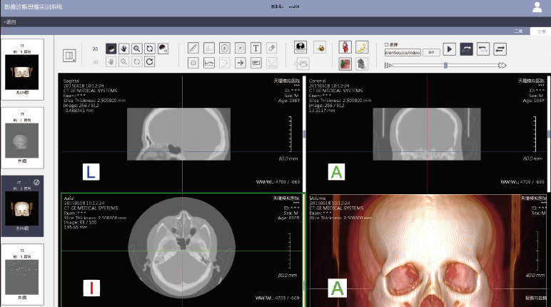 影像诊断思维实训系统
